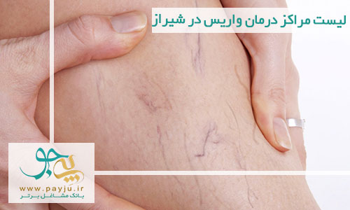 لیست مراکز درمان واریس در شیراز