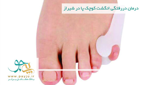درمان دررفتگی انگشت کوچک پا در شیراز