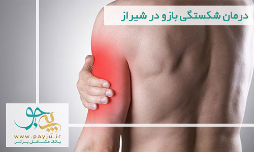 درمان شکستگی بازو در شیراز