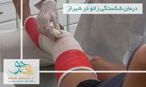 درمان شکستگی زانو در شیراز