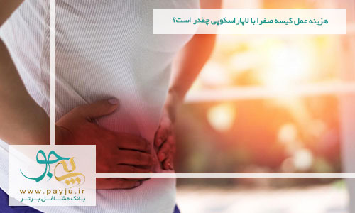 هزینه عمل کیسه صفرا با لاپاراسکوپی چقدر است؟ هزینه عمل کیسه صفرا با لاپاراسکوپی چقدر است؟