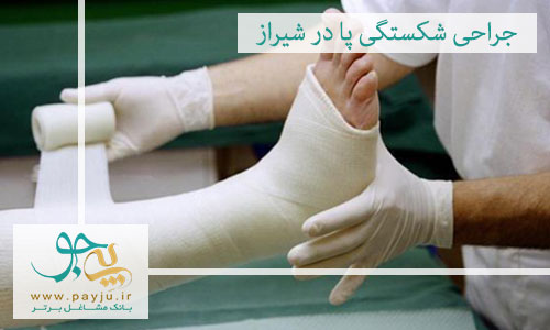جراحی شکستگی پا در شیراز