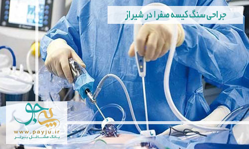 جراحی سنگ کیسه صفرا در شیراز