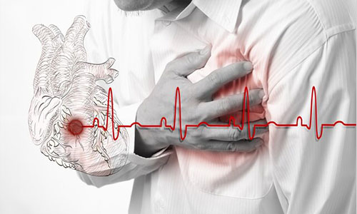 توصیه‌های متخصص قلب به بیماران قلبی برای پیشگیری از کرونا