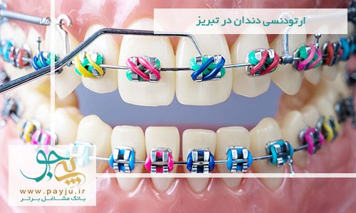 ارتودنسی دندان در تبریز