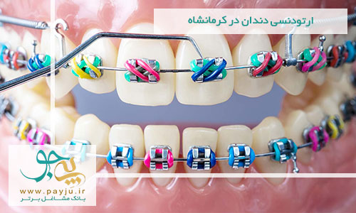 ارتودنسی دندان در کرمانشاه