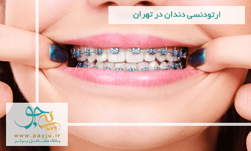 ارتودنسی دندان در تهران