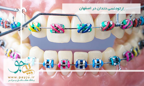 ارتودنسی دندان در اصفهان