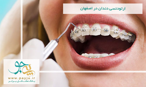 ارتودنسی دندان در اصفهان
