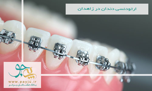 ارتودنسی دندان در زاهدان