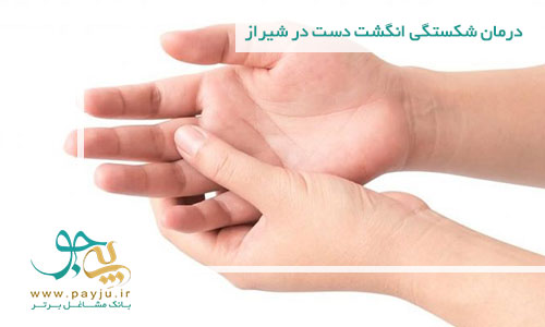 درمان شکستگی انگشت دست در شیراز