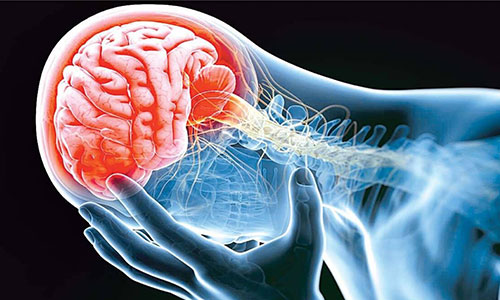 3 درصد مبتلایان کرونا به سکته مغزی دچار می‌شوند