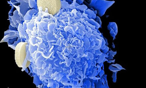 مهار متاستاز سرطان روده بزرگ با کمک یک مولکول کوچک