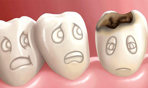19 عادتی که باعث خرابی دندان شما را می شود