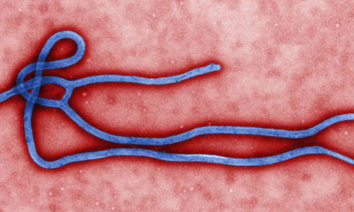 ویروس ابولا چیست ؟