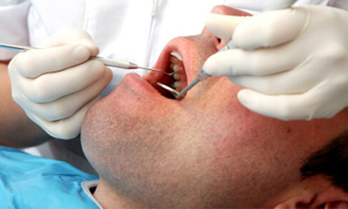 چگونه سرطان لب و حفره دهان درمان مي‌شود