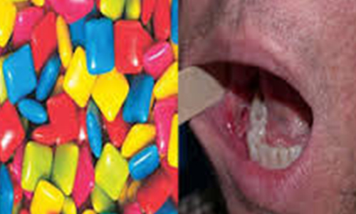 بروز سرطان دهان مهم‌ترین خطرات استفاده از «پان» است