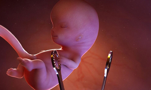 زایمان زودرس و سقط جنین از عوارض کم‌کاری تیروئید در دوران بارداری