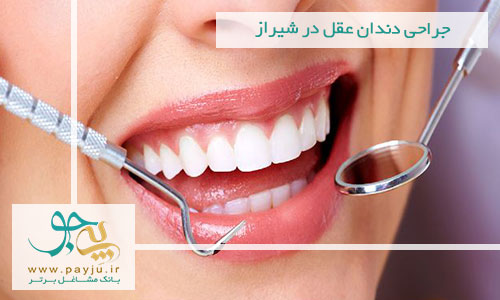 جراحی دندان عقل در شیراز | کشیدن دندان عقل در شیراز