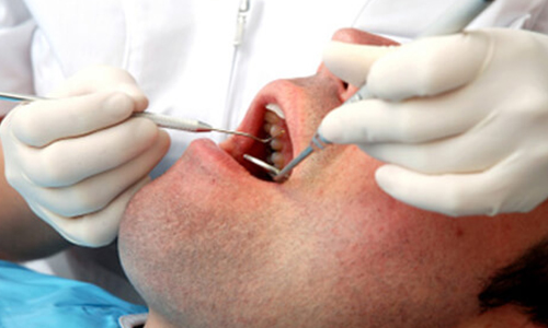 سرطان دهان علت اصلي مراجعه به دندان پزشكي است