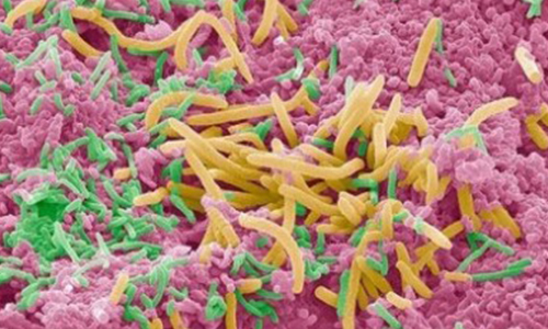 نقش ميكروب هاي دهان در سرطان روده بزرگ