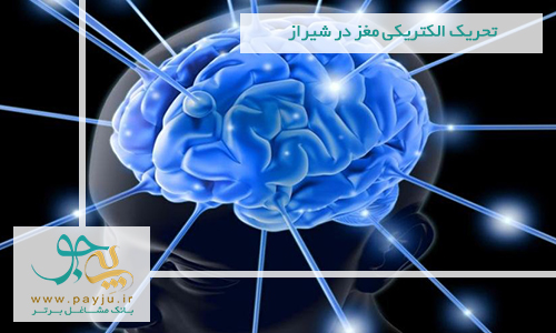 تحریک الکتریکی مغز در شیراز