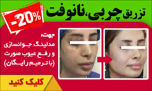 مراکز تزریق چربی در شیراز - دکتر زهرا نوری زاده