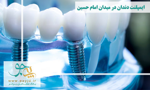  ایمپلنت دندان در میدان امام حسین