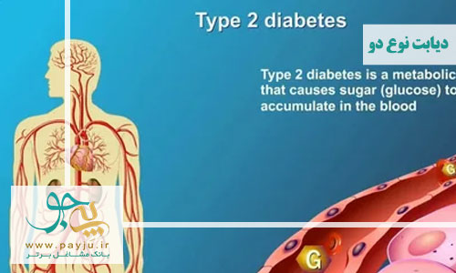 دیابت نوع 2 چیست؟ از درمان تا پیشگیری