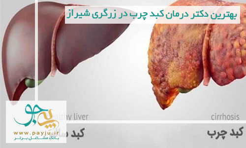 دکتر درمان کبد چرب در زرگری شیراز
