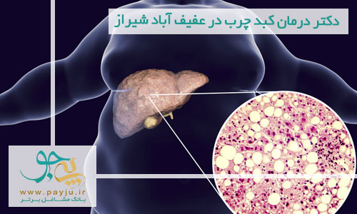 دکتر درمان کبد چرب در عفیف آباد شیراز