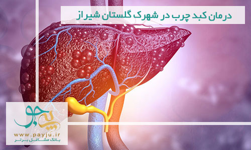 درمان کبد چرب در شهرک گلستان شیراز