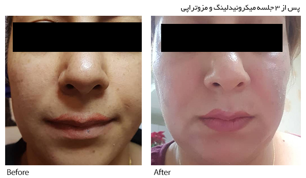 دکتر ولی حسنی