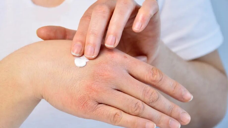 5 اشتباه مراقبت از پوست برای پوست های حساس که باید از آن اجتناب کنید
