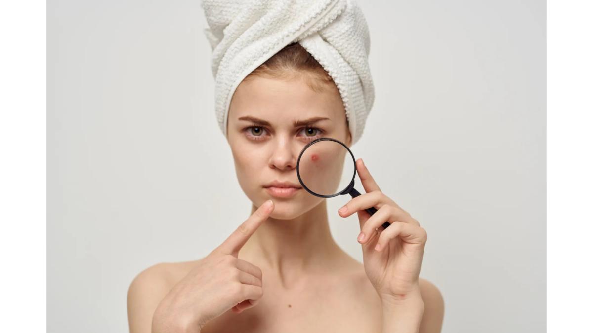 5 اشتباه مراقبت از پوست که در صورت داشتن پوست چرب باید از آن اجتناب کنید