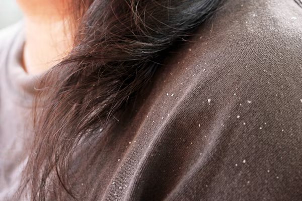 7 دلیل استفاده از روغن جوجوبا برای مو