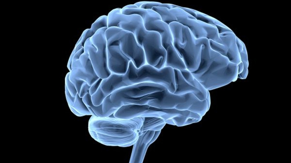 آیا این اختلالات رایج مغزی می دانستید؟