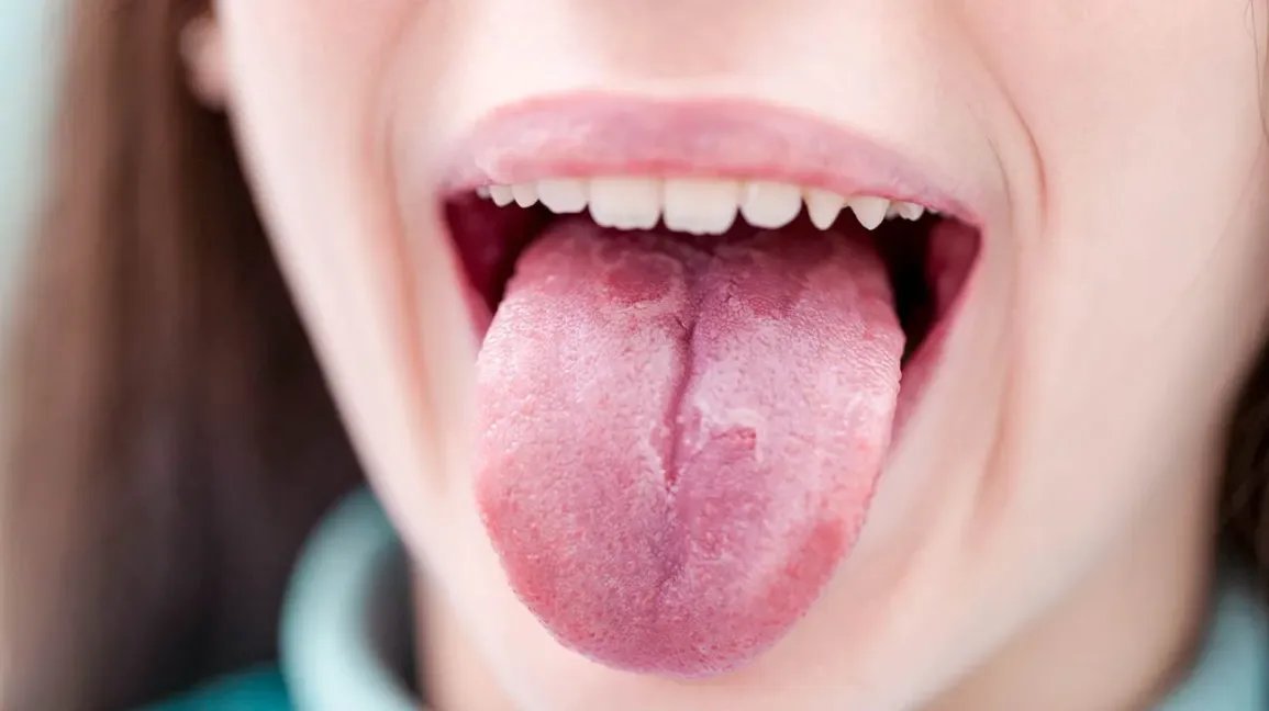 چه چیزی باعث درد زبان می شود و بهترین درمان های خانگی موثر چیست