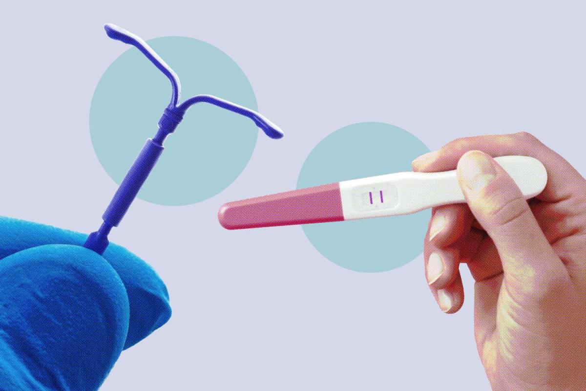 حقایق در مورد IUD و چرا شما ممکن است به آن نیاز داشته باشید