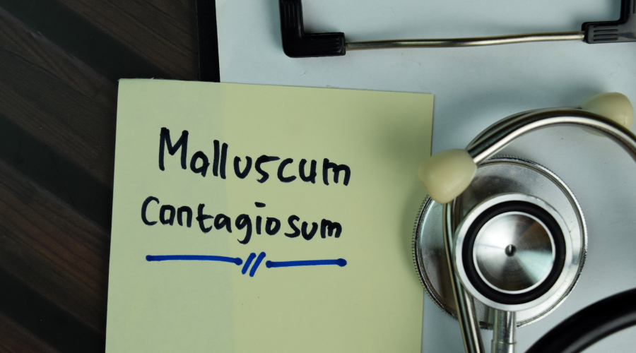 مولوسکوم کونتاژیوزوم چیست