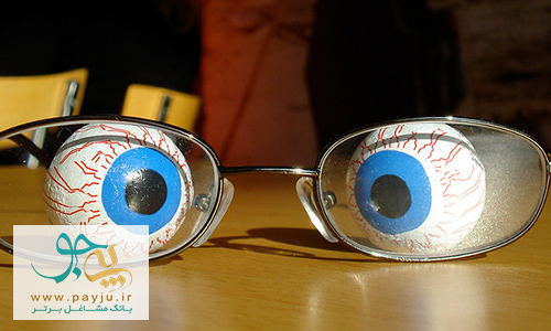  بیماری های چشم : انحراف چشم یا استرابیسم