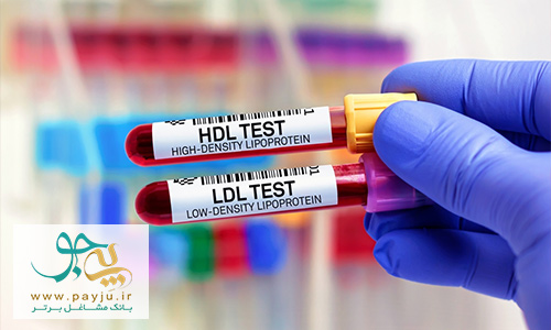 انواع کلسترول خوب و بد LDL و HDL