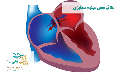 علائم نقص سپتوم دهلیزی و سوراخ قلب
