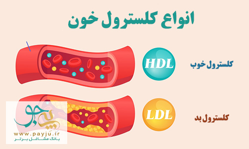 علت کلسترول بالا - سطح HDL پایین و LDL بالا