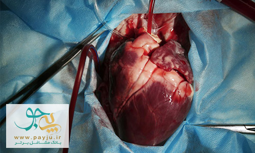 عکس قلب واقعی انسان در حین عمل