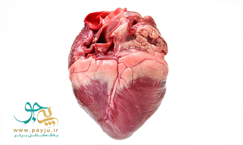 عکس واقعی قلب انسان و آناتومی آن