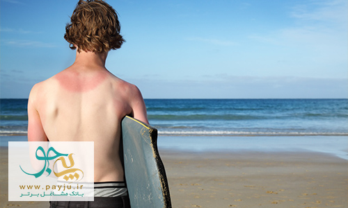 کاهش خطر آفتاب سوختگی و سرطان پوست با کرم ضد افتاب