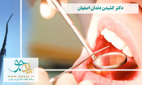 دکتر کشیدن دندان اصفهان