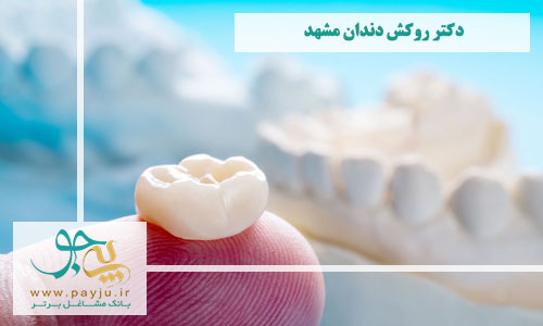 دکتر روکش دندان مشهد