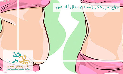 جراحی زیبایی شکم و سینه در معالی آباد شیراز